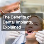 The Benefits of Dental Implants, Explained